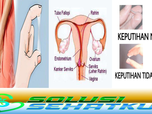 Penyebab Keputihan Pada Wanita