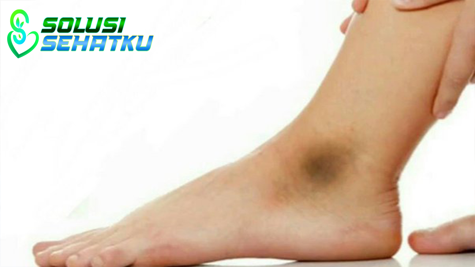 Ketahui Penyebab dan cara mengatasi Mata kaki yang menghitam